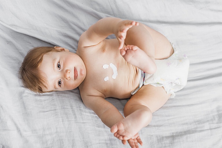 Tips to Keep Your Baby's Skin Healthy