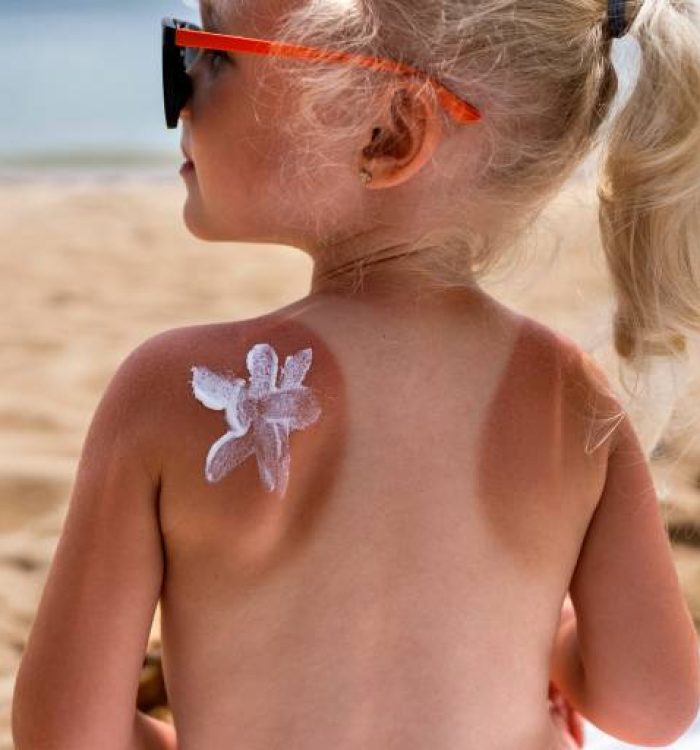 How to Protect Your Baby’s Skin from the Sun?